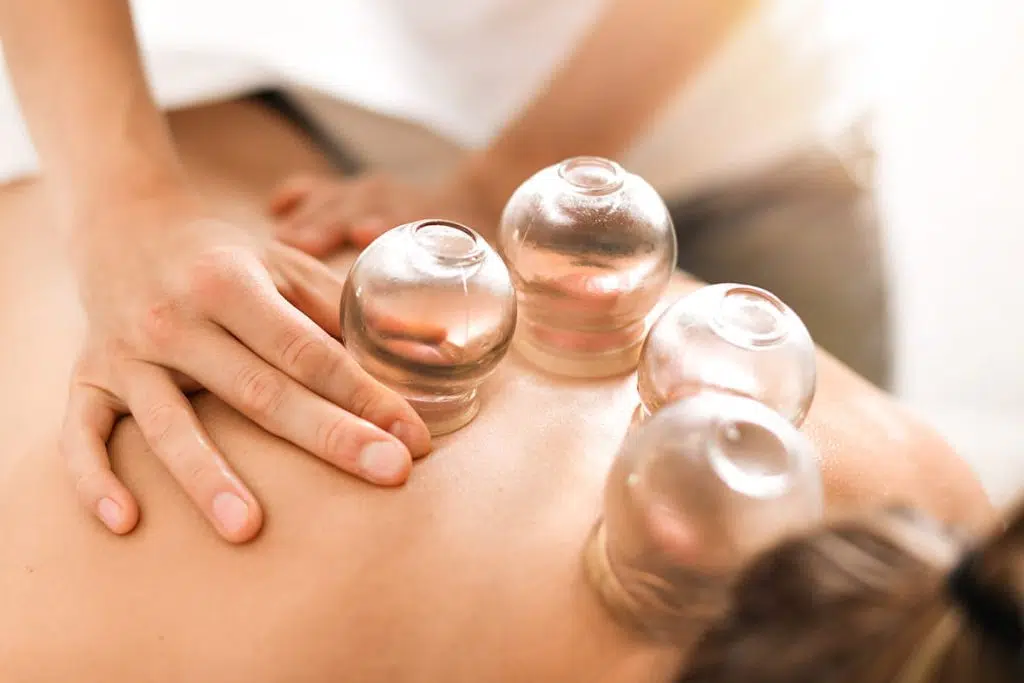 Could You Benefit From Cupping Therapy